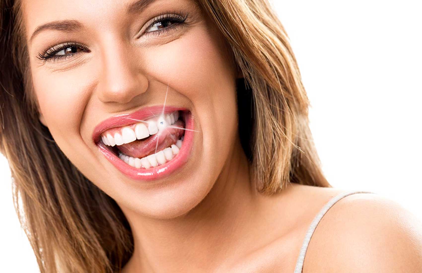 Applicazione Brillantino Swarovski o Diamante Dente Studio Benessere del Sorriso Tavagnacco -43%